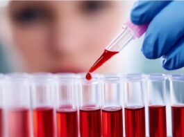 Leucemia mieloide crónica: el avance de la ciencia mejora la calidad de vida de los pacientes