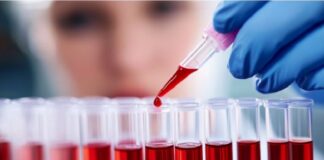 Leucemia mieloide crónica: el avance de la ciencia mejora la calidad de vida de los pacientes