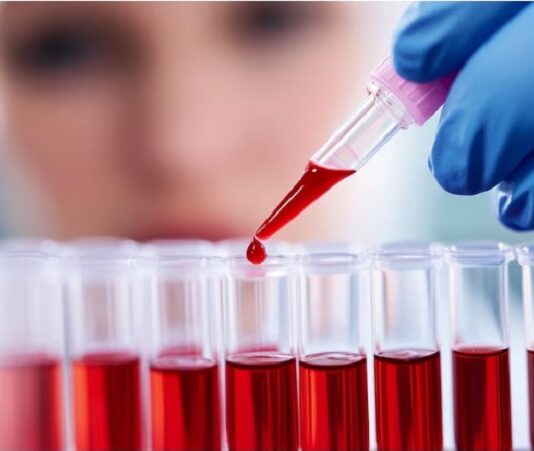 Leucemia mieloide crónica: el avance de la ciencia mejora la calidad de vida de los pacientes