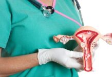 Optimizar el control ginecológico, la clave contra el cáncer de cuello uterino