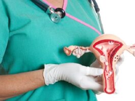 Optimizar el control ginecológico, la clave contra el cáncer de cuello uterino