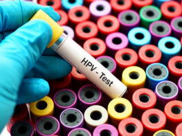 HPV: campaña mundial para concientizar sobre esta infección