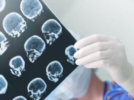 Parkinson: una enfermedad poco visibilizada que crece y afecta a más de 100 mil argentinos