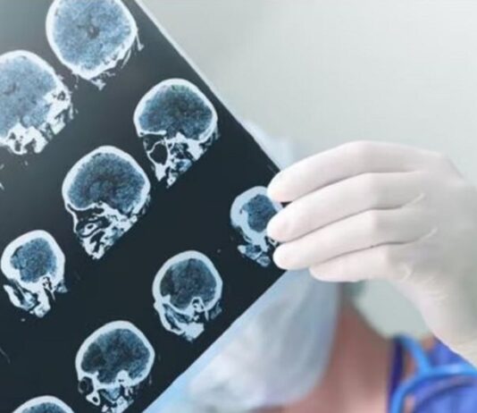 Parkinson: una enfermedad poco visibilizada que crece y afecta a más de 100 mil argentinos