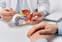 Cáncer de próstata: aseguran que la mortalidad registró un descenso sostenido entre 2014 y 2024